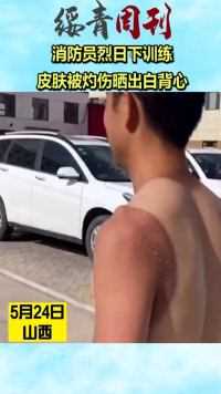 消防员烈日下训练，皮肤被灼伤晒出白背心
